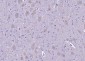 Calmodulin 1/2/3 Rabbit pAb